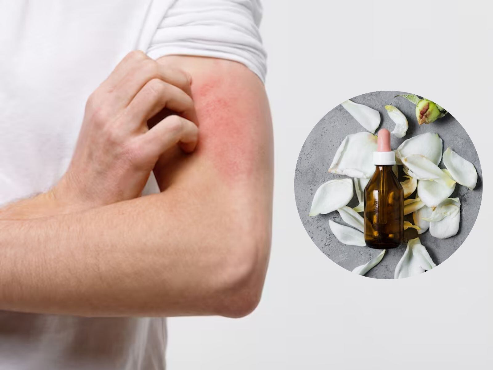 TRUCOS CASEROS | Esta flor se usa también para la preparación de postres o dulces. (Foto: dimaberlin / freepik)