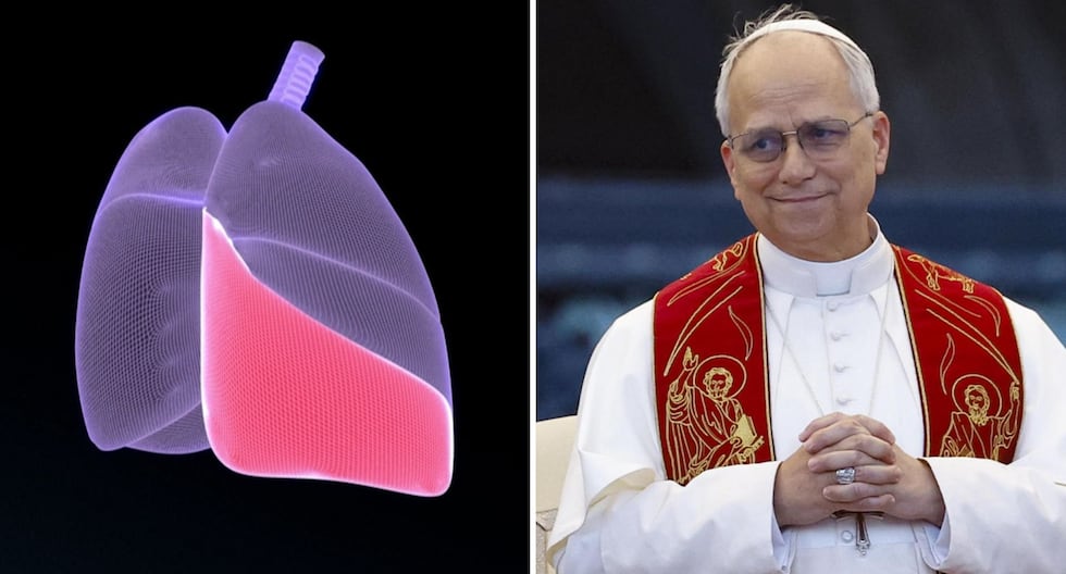 Radiografía confirma buena evolución del Papa León XIV