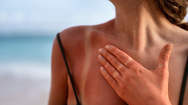 Protección contra el calor: 8 enfermedades producidas por la exposición excesiva a los rayos UV y cómo prevenirlas