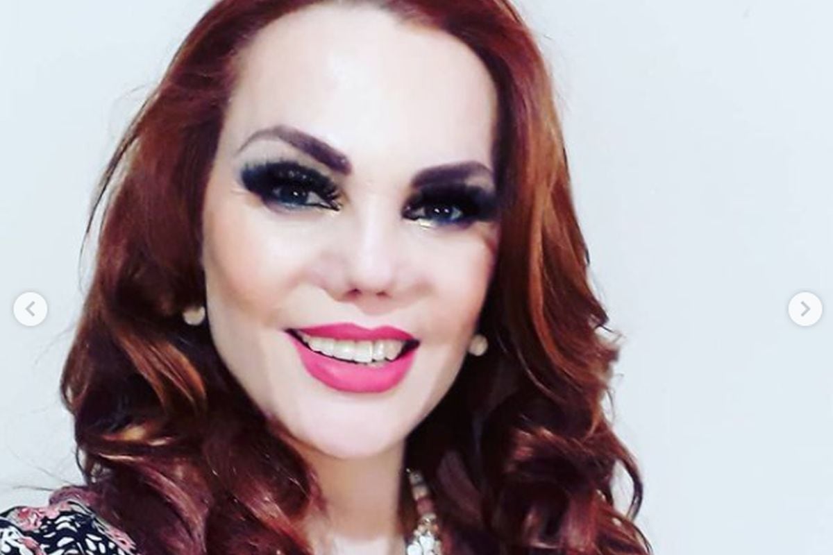 Modelo y actriz contó como fue el proceso para que puedan reconstruir su nariz (Foto: Carmen Campuzano / Instagram)