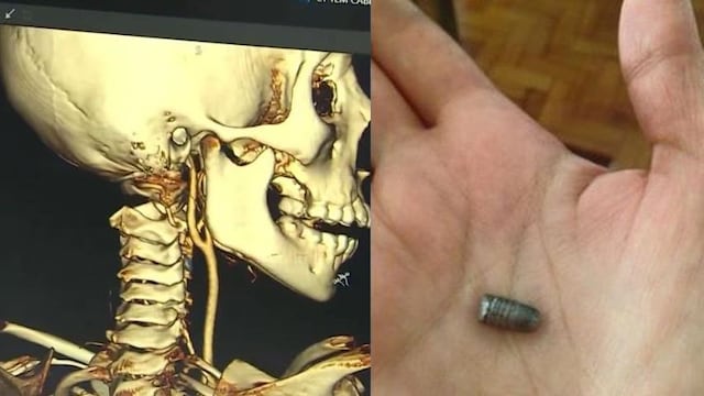 La menor de 9 años se encontraba haciendo una tarea grupal del colegio en casa de un compañero, en el sector de Puerto Nuevo (Callao), cuando se produjo el tiroteo que cambiaría su vida.