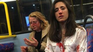 Pareja de lesbianas sufre ataque homófobo en un autobús de Londres
