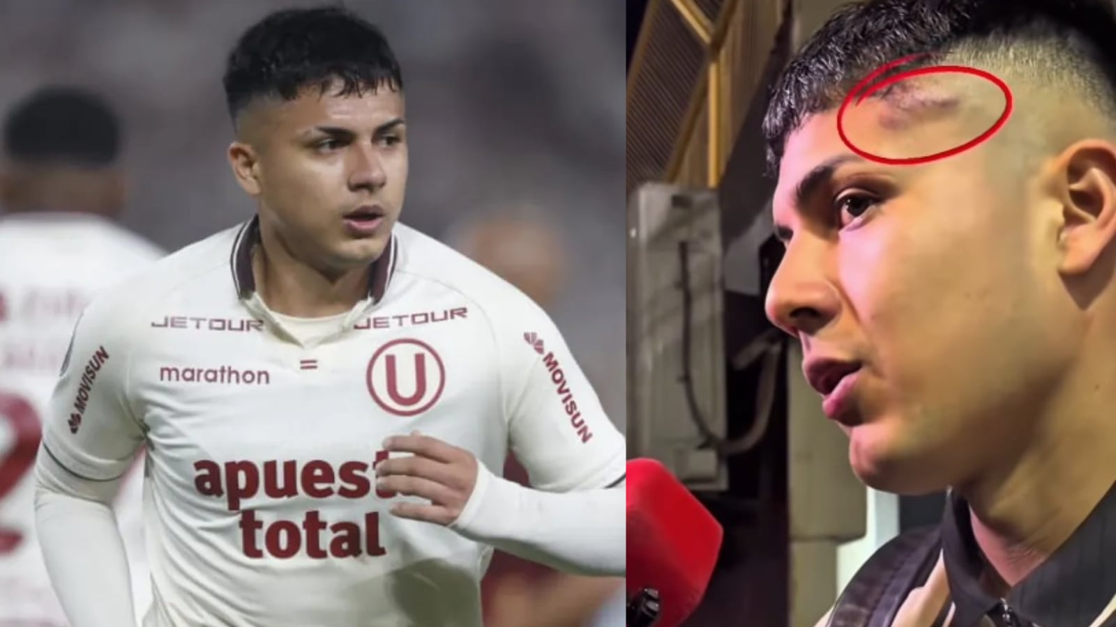 Casi le abren la ceja: Así quedó el rostro de Jairo Concha tras fuerte golpe de Zevallos | VIDEO