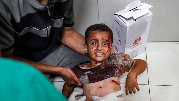 Un niño herido es tratado en el suelo de una sala de traumatología del Complejo Médico Nasser en Khan Yunis, en el sur de la Franja de Gaza, el 16 de julio de 2024. (Foto de Bashar TALEB / AFP).