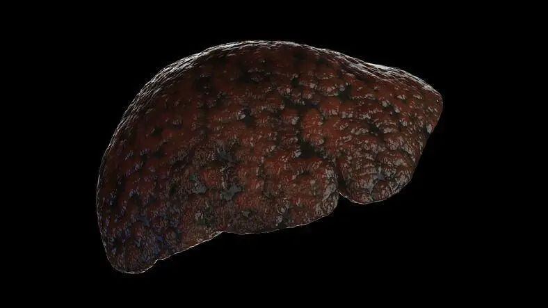 Hay una serie de factores que pueden dañar el hígado, desde virus hasta exceso de grasa.