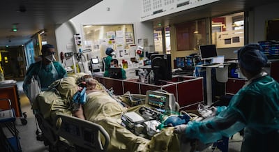 Francia reporta muerte de infectado con virus shamonda: cómo se contagia y por qué todavía no es un riesgo