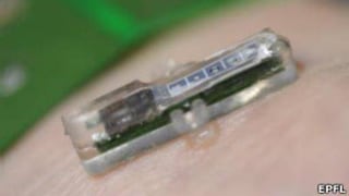 Laboratorio bajo la piel: implante electrónico realiza análisis constantes de sangre