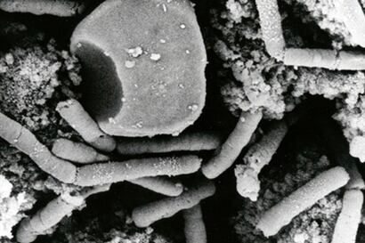 ¿Podrá la diplomacia salvar al mundo de las bacterias?