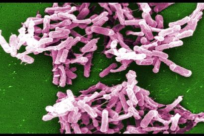 Bacterias intestinales, emociones y autismo