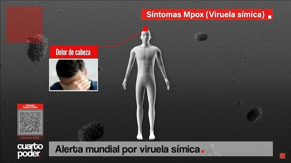 Cuarto Poder: Alerta mundial por la viruela símica