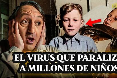 La lucha contra la Polio en Perú