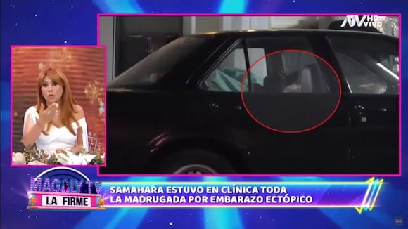 Samahara Lobatón tuvo un embarazo ectópico