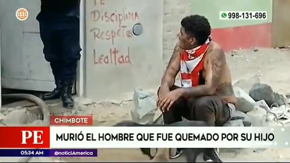 Chimbote: Murió padre que fue quemado por su hijo