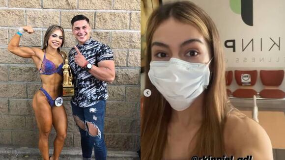 México: influencer muere tras someterse a tratamiento contra la sudoración excesiva