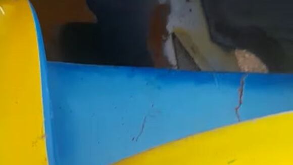 Niña pierde tres dedos