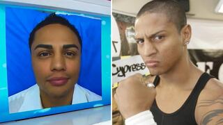 Jonathan Maicelo: ¿Cuántas cirugías se realizó en el rostro?