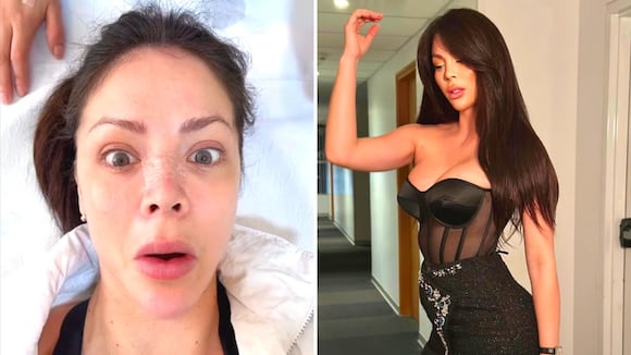 Sheyla Rojas estrena nueva nariz