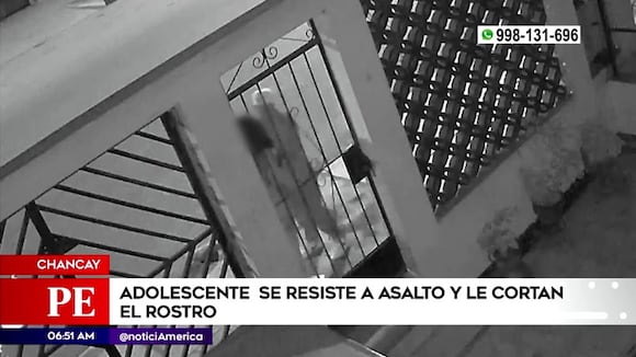 Chancay: cortan rostro a joven tras resistirse a robo