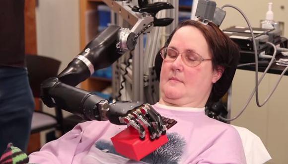 Mujer tetrapléjica usa la mente para controlar brazo robótico
