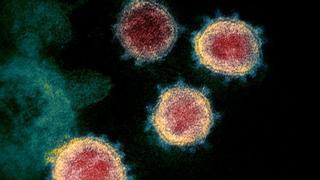 Coronavirus: el misterioso “gen dentro del gen” que descubrieron escondido dentro del SARS-CoV-2 
