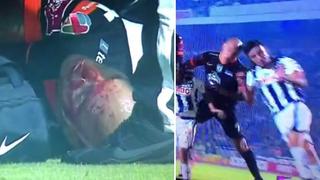 Vine: futbolista sufrió terrible lesión en la cabeza (VIDEO)