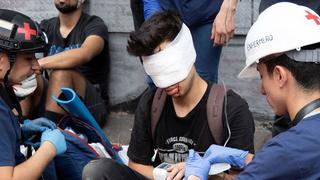 Chile: detienen a policía que habría dejado ciego a Gustavo Gatica en protestas del año pasado