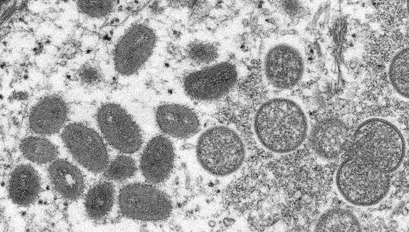 La viruela del mono vista bajo un microscopio electrónico. (CDC/REUTERS).