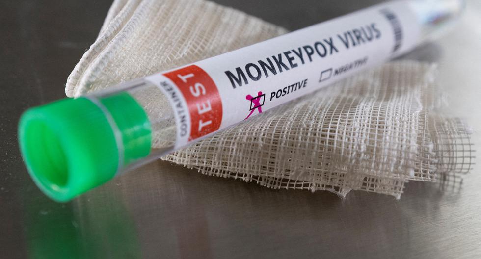 Argentina confirms a third case of monkeypox