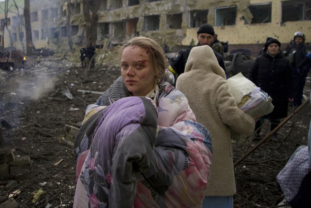 Mariana Vishegirskaya in front of the bombed hospital.  (AP/Mstyslav Chernov).