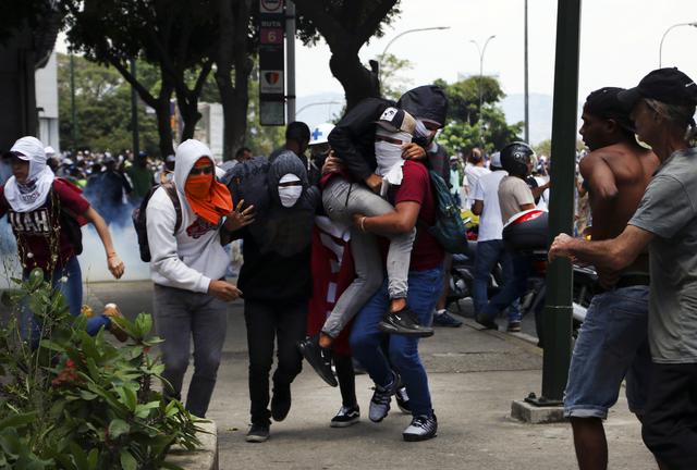Venezuela | Las fotos de la violenta represión en el país. (Rolly Reyna / El Comercio)