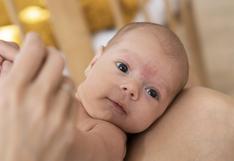 ¿Cómo lidiar con la costra láctea en bebés? Consejos para el adecuado manejo de la piel sensible