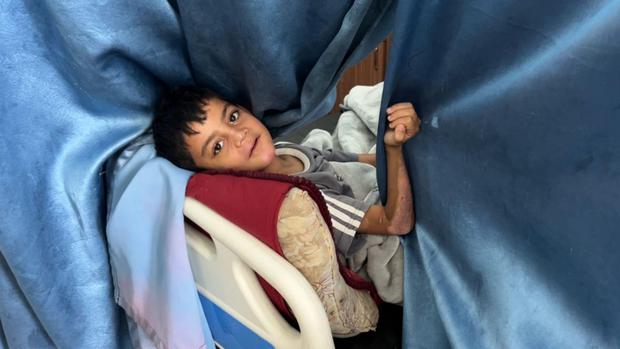 Los niños se encuentran entre las víctimas más numerosas en Gaza.