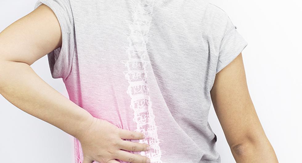 En esta nota te presentamos algunos tips para cuidar tu columna vertebral. (Foto: IStock)