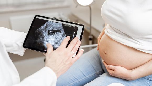 En el 2016, llegó la ecografía 5D con lo cual a gestante puede ver de manera más realista a su bebé. Foto: Shutterstock