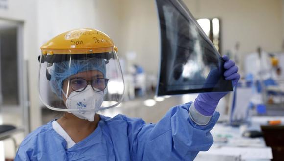 Una enfermera que mira la radiografía de los pulmones de Valerio Santa Cruz, de 90 años, que fue dado de alta del Hospital Estatal Dos de Mayo tras padecer de coronavirus. (Foto: Ministerio de Salud de Perú / AFP)