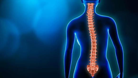 Trastorno de la columna vertebral, escoliosis, lesión en la columna vertebral, anatomía humana y conceptos médicos.
