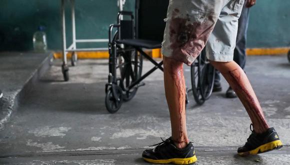 Venezuela | "Cuando volteé, ya tenía una bala en el pie": Así fue la "represión" chavista en Caracas. ()