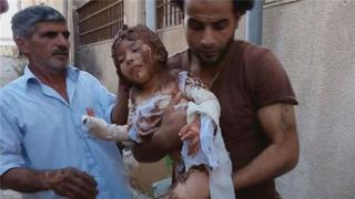 Siria: Tratan a niños heridos con barro por la falta de insumos