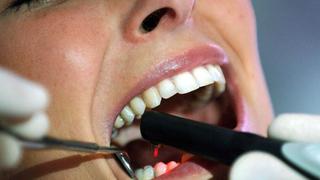 Ciencia ignora enfermedades dentales de 3.500 millones de personas