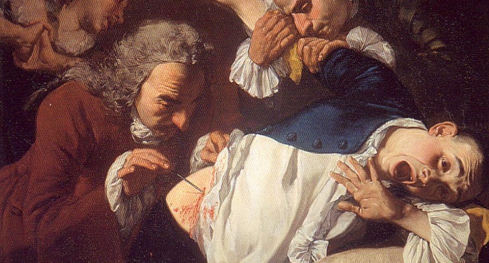 La práctica médica fue cambiando en el siglo XIX. (Cuadro La operación (1753) de Gaspare Traversi/Dominio Público)