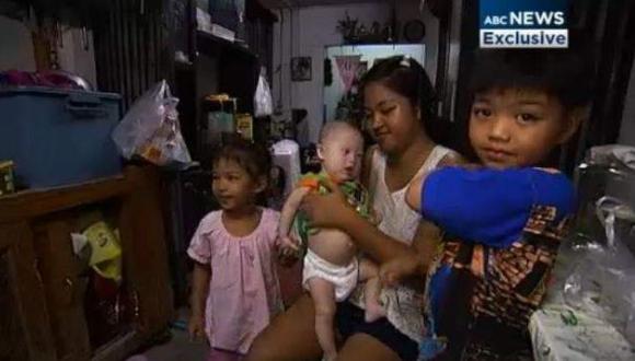 Gammy junto a su familia en Tailandia. (Imagen: Captura de ABC News)