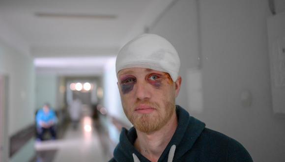 Un joven ucraniano, herido durante los ataques rusos, observa en un pasillo del hospital central de Mykolaiv, a 100 km de Odesa, en el oeste de Ucrania, el 8 de marzo de 2022. (BULENT KILIC / AFP).