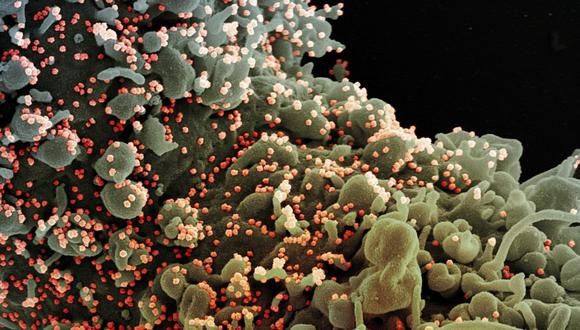 Esta imagen del folleto sin fecha obtenida el 15 de julio de 2020, cortesía del Instituto Nacional de Alergias y Enfermedades Infecciosas muestra una célula que muestra signos morfológicos de apoptosis, infectada con partículas del virus SARS-COV-2 ( naranja), aislada de un muestra de un paciente.  (Foto: National Institute of Allergy and Infectious Diseases / AFP)