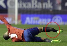 Real Madrid vs Osasuna: terrible fractura de tibia y peroné de Tano Bonnín