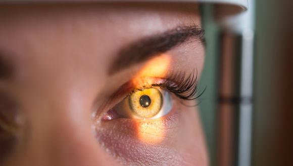 El trabajo, publicado en la revista de neurociencias "Alzheimer's Research and Therapy", confirma "la posibilidad de usar el ojo como herramienta adicional para el diagnóstico y monitorización terapéutica del alzheimer"(Foto referencial: Shutterstock)