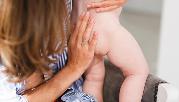 Para evitar que el niño desarrolle dermatitis, es importante que el pañal sea cambiado frecuentemente.