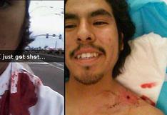 Snapchat: comparte 'selfie' luego de ser baleado