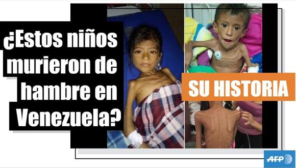 Las historias detrás de las fotos virales en facebook con dos niños esqueléticos en Venezuela. (AFP).