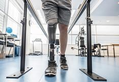 Prótesis robóticas e implantes cerebrales frente a la discapacidad
