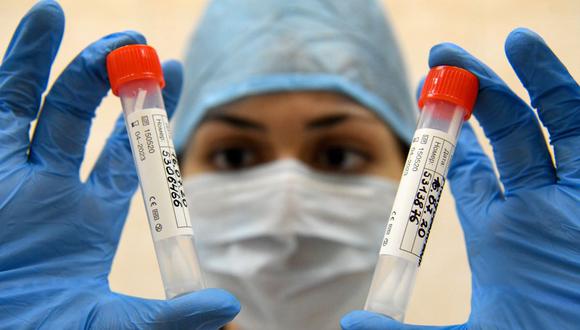 Una enfermera muestra pruebas de detección del coronavirus en un centro médico de Moscú, Rusia, el 16 de julio de 2020. (Foto referencial, Kirill KUDRYAVTSEV / AFP).